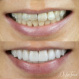 Bloom Dental Group, dentists office located at 800 S B St, San Mateo, CA.