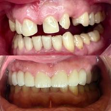 Almore Dental Studio , dentists office located at 737 Holly Ln, Westampton , NJ.